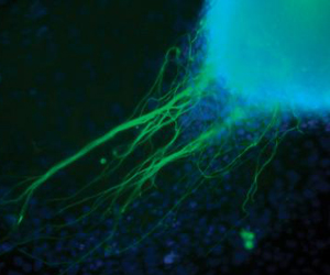 iPS Heart Nerve Cell