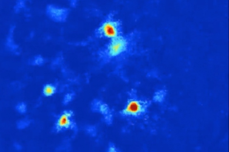 Using optogenetics, anxiety cells in the brains of mice light up when the animal is stressed. Image by Lab of Rene Hen, Columbia University Irving Medical Center