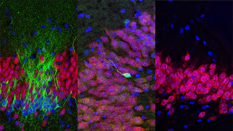 Young neurons (green) are shown in the human hippocampus at the ages of (from left) birth, 13 years old and 35 years old. Images by Arturo Alvarez-Buylla lab