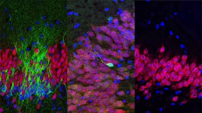 Young neurons (green) are shown in the human hippocampus at the ages of (from left) birth, 13 years old and 35 years old. Images by Arturo Alvarez-Buylla lab